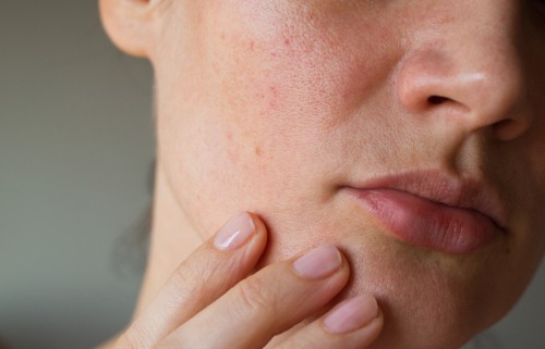 Advantages And Disadvantages Of Facial Massage