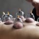 All About Cupping Therapy in Massage