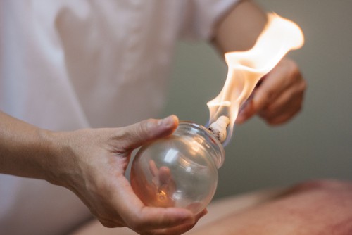 Frequently Asked Questions About Cupping Therapy